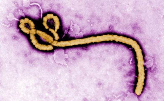 Merck’in Geliştirdiği Ebola Aşısı Etkisini Gösterdi  ...Copyright (C) Gerçek Bilim kaynağını göstermeden paylaşmak ve yayınlamak yasaktır, http://www.gercekbilim.com/merck-ebola-asisi-etkisini-gosterdi/ .
