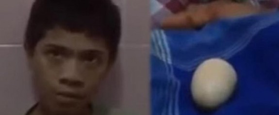 Endonezya'da yumurtladığını iddia eden çocuk