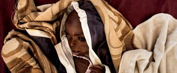 BM: Kongo'da 400 bin çocuk açlıktan ölebilir