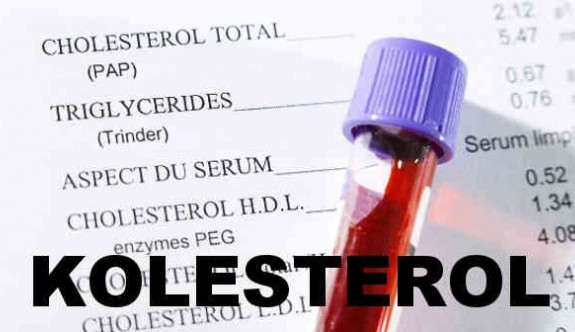 Yüksek Kolesterolün Belirtisi Olabilecek 9 Durum