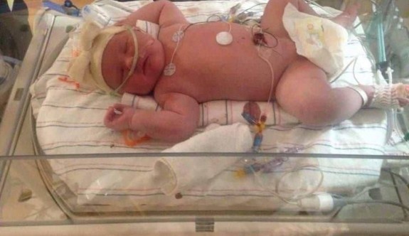 Yeni doğan bebeğin kilosu herkesi şaşırttı !