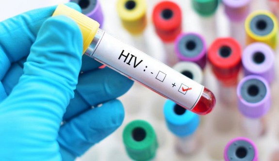 75 kişi HIV hastası