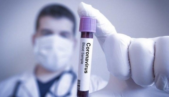 Corona virüsünde panik: Ölü sayısı yine arttı, her gün 100 kişi yakılıyor iddiası
