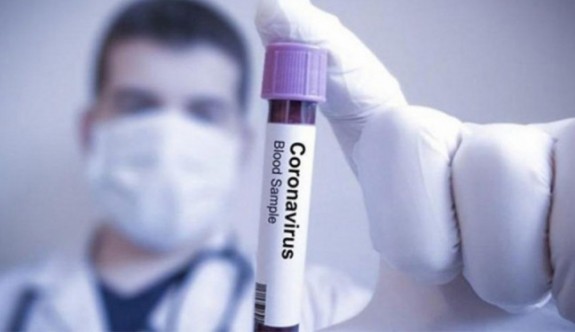 Sağlık Bakanlığı, korona virüsüne karşı aldığı tedbirleri artırdı
