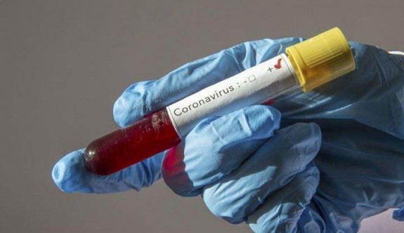 "Bugün 38 kişide pozitif koronavirüs tespit edildi"