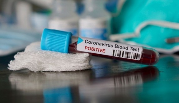 Güney'de 17 yeni koronavirüs vakası daha