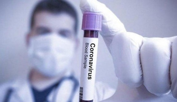 Rusya’dan koronavirüs için umut veren iddia