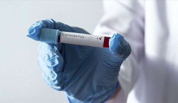 Dünyada koronavirüs vaka sayısı 1 milyon 700 bini geçti