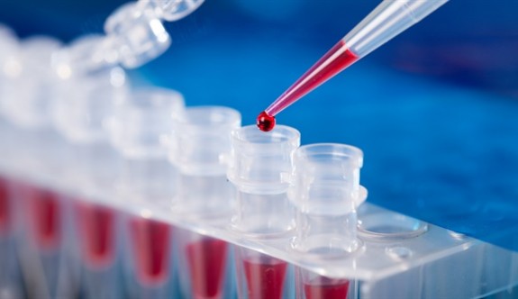 Gazimağusa Devlet Hastanesi COVID-19 RT-PCR testleri yapılmaya başlandı