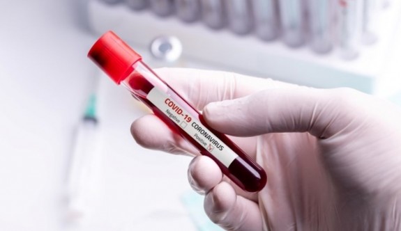 Corona virüse karşı en riskli kan grubu belirlendi