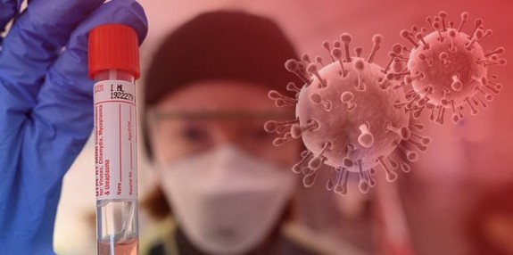 Dünya genelinde koronavirüs vaka sayısı 7,5 milyonu aştı