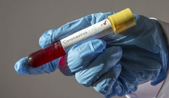 Dünyada koronavirüs vaka sayısı 9 milyonu geçti