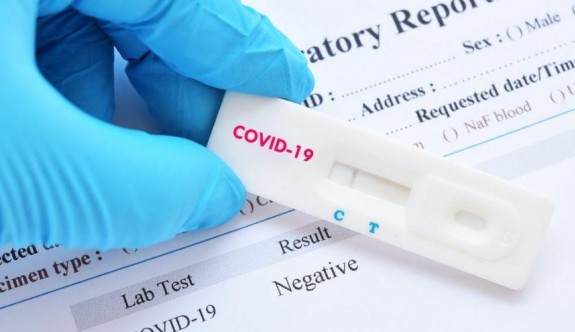 Güney'de koronavirüs test fiyatları yarıya düştü