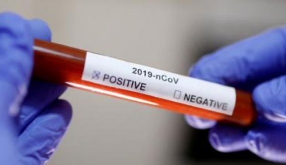 Dünya genelinde koronavirüs vakası 18 milyonu aştı