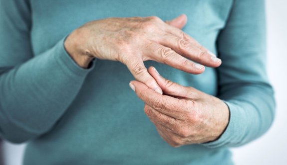 Şiddetli ağrılara neden olan el kireçlenmesi kadınlarda daha sık görülüyor
