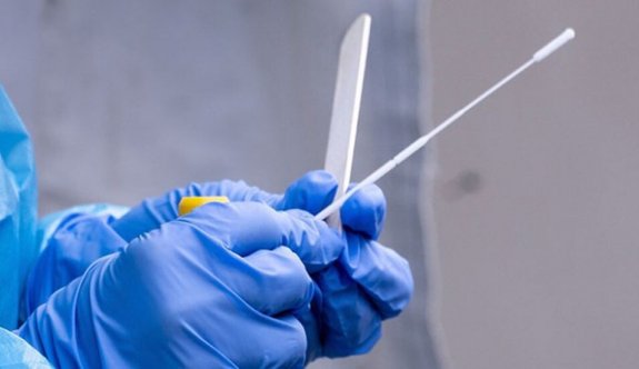PCR testi yerine neden antijen test yapılmak isteniyor?