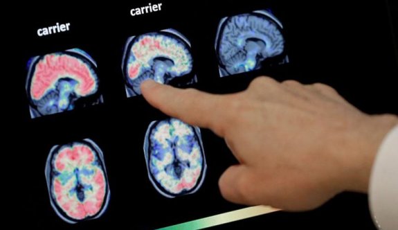 ABD'de bir çocuk beyin yiyen amip nedeniyle hayatını kaybetti