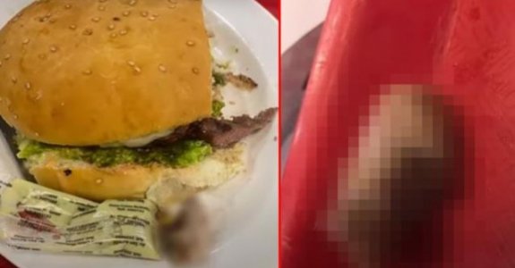 Bolivya’da bir kadının yediği hamburgerin içinden insan parmağı çıktı
