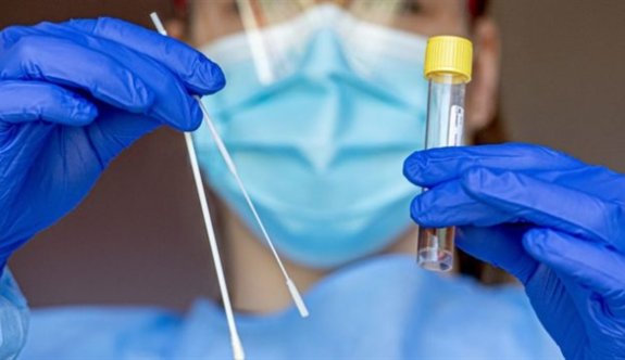 “PCR/Antijen Testleri ve Karantina Ücretleri”ne ilişkin yeni kararlar Resmi gazetede yayınlandı