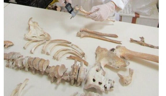 Antik DNA’lar Pompei kurbanlarının sırlarını açığa çıkarıyor