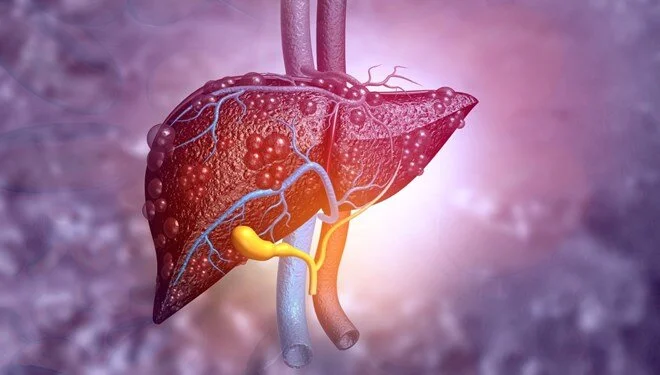 Araştırma: Karaciğer yağlanması beyne zarar veriyor