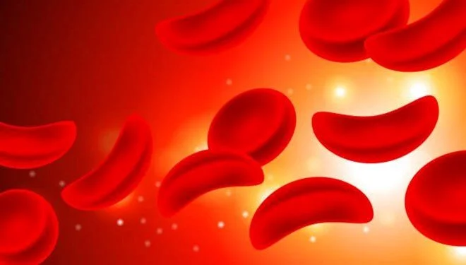 Yeni araştırma: A kan grubunun felç riski yüksek